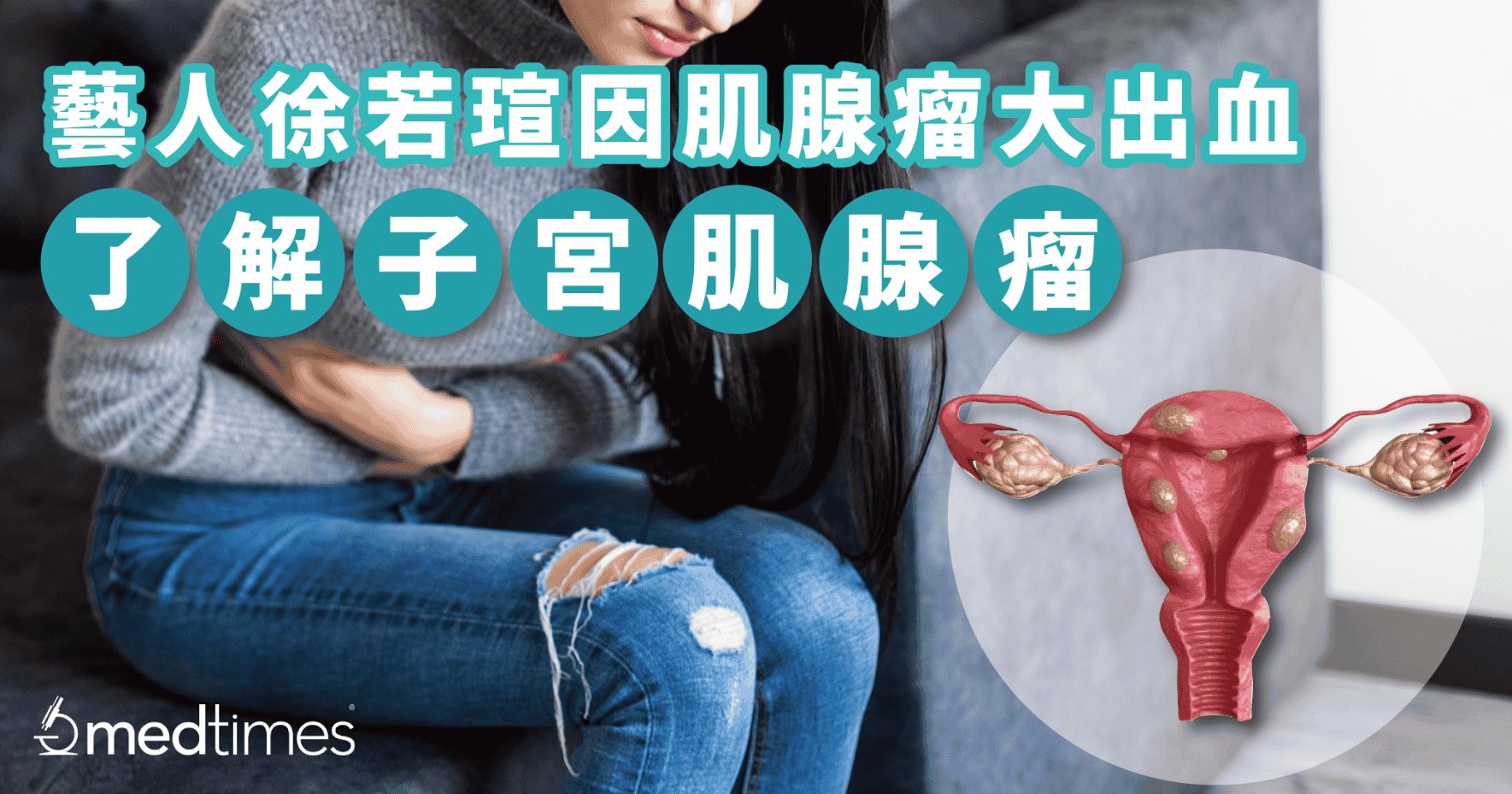 艺人徐若瑄「肌腺瘤长大出血」！了解子宫肌腺瘤是什么